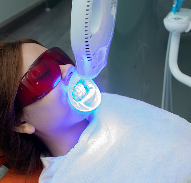 White Smile Dental - Tẩy Trắng Răng Công Nghệ Plasma Cao Cấp 2026. Voucher 2,500,000 VNĐ, Còn 990,000 VNĐ, Giảm 60%. Chỉ Có Tại Hotdeal.vn!