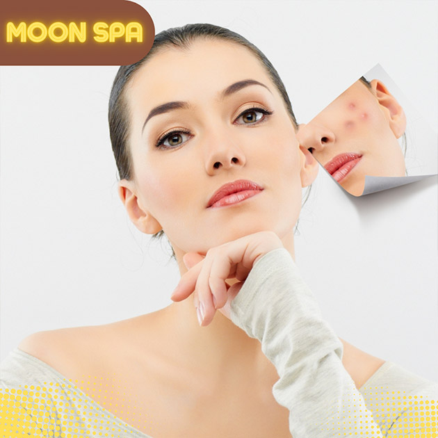 Golden Moon Spa - Trị Mụn Chuẩn Y Khoa. Voucher 350,000 VNĐ, Còn 89,000 VNĐ, Giảm 75%. Chỉ Có Tại Hotdeal.vn!