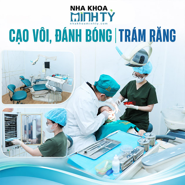 Nha Khoa Minh Tỷ - Cạo Vôi, Đánh Bóng/ Trám Răng. Voucher 400,000 VNĐ, Còn 69,000 VNĐ, Giảm 83%. Chỉ Có Tại Hotdeal.vn!