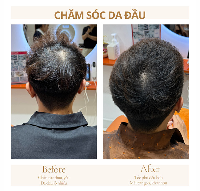 LHALA# Spa & Salon - Nhuộm + Phục Hồi/ Meso Không Kim/ Chăm Sóc Da Đầu. Voucher 1,200,000 VNĐ, Còn 299,000 VNĐ, Giảm 75%. Chỉ Có Tại Hotdeal.vn!