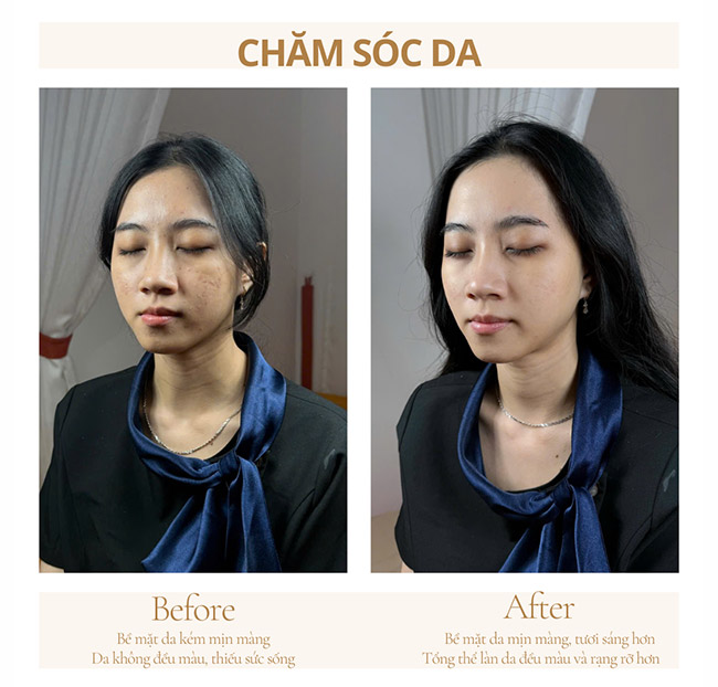 LHALA# Spa & Salon - Nhuộm + Phục Hồi/ Meso Không Kim/ Chăm Sóc Da Đầu. Voucher 1,200,000 VNĐ, Còn 299,000 VNĐ, Giảm 75%. Chỉ Có Tại Hotdeal.vn!