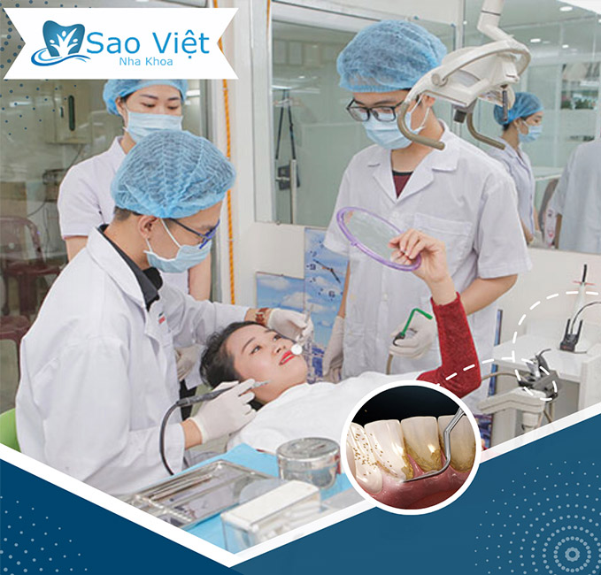 Nha Khoa Sao Việt - Cạo Vôi, Đánh Bóng/ Trám Răng Chất Lượng Cao. Voucher 150,000 VNĐ, Còn 49,000 VNĐ, Giảm 67%. Chỉ Có Tại Hotdeal.vn!