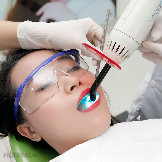 Nha Khoa Sao Việt - Cạo Vôi, Đánh Bóng/ Trám Răng Chất Lượng Cao. Voucher 150,000 VNĐ, Còn 49,000 VNĐ, Giảm 67%. Chỉ Có Tại Hotdeal.vn!