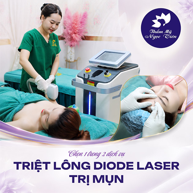 Thẩm Mỹ Ngọc Tiên - 10 Lần Triệt Lông Diode Laser/ Trị Mụn . Voucher 1,500,000 VNĐ, Còn 99,000 VNĐ, Giảm 93%. Chỉ Có Tại Hotdeal.vn!