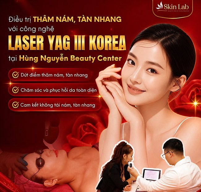 1 Lần Điều Trị Nám